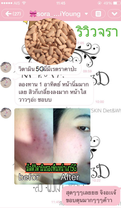 #มัลติวิตามินรองพื้นหน้าเงา5G‎หน้าขาว‬ ‪#‎สิวหาย‬ ‪#‎รูขุมขนกระชับ‬ โดยไม่ต้องพึ่งครีมบำรุง ‪#‎อัดวิตามินเต็มโดสใน‬ 1 เม็ด ตัวนี้ เริ่ดมากๆๆๆๆ การันตีใน 7 วัน 5 วัน ‪#‎ผิวนุ๊มนุ่ม‬ ผิวลื่นเนียนชัดเจน 7 วัน ผิวเริ่มขาว ‪#‎สว่างมีออร่า‬ 15 วัน ‪#‎สิวหายเกลี้ยง‬ #รูขุมขนกระชับ ‪#‎อวดหน้าสด‬ ‪#‎ผิวออร่าอย่างแท้จริง‬