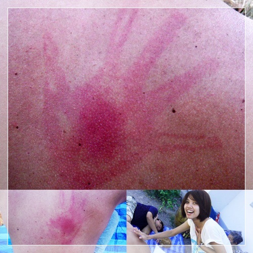 ฝากรูป