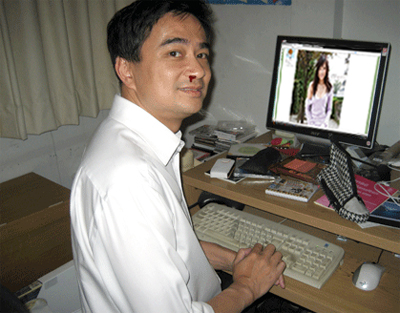 ฝากรูป