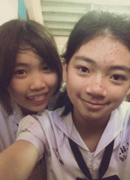 ฝากรูป