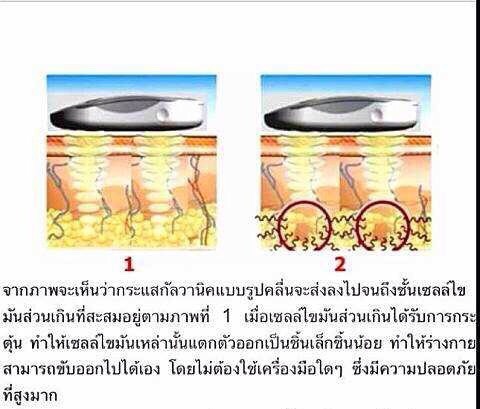 สปาตัวลดเซลลูไลต์
