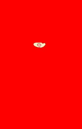 quick post