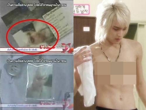 ฝากรูป