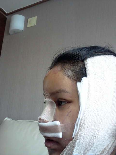 ฝากรูป