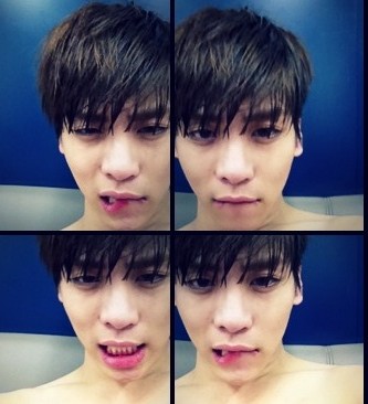 ฝากรูป
