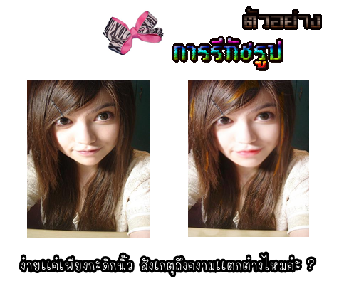 ฝากรูป