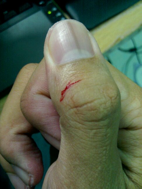 ของแถมมื้อดึก