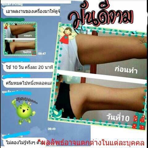กระชับต้นแขน