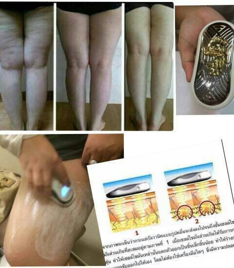 ลดขา