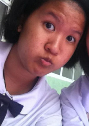 ฝากรูป