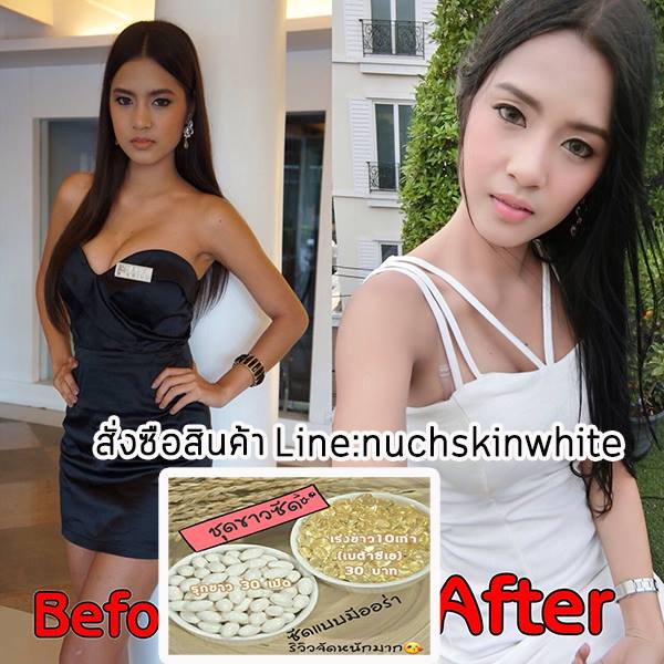 เซตขาวซีด2