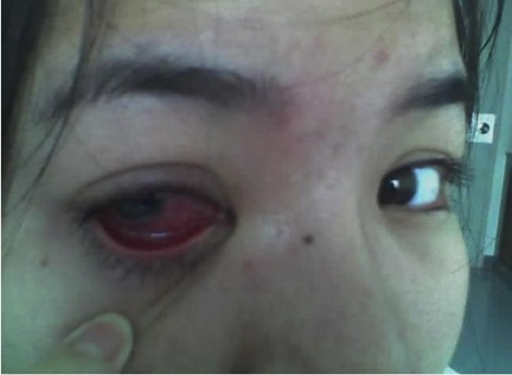 ฝากรูป