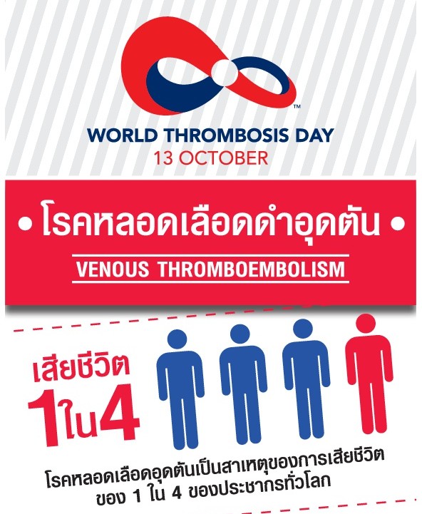 หมอเผย คนไทยน้อยมากรู้ถึงอันตรายร้ายแรงจากโรคลิ่มเลือดอุดตันของหลอดเลือดดำ