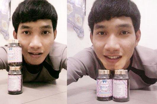 ฝากรูป