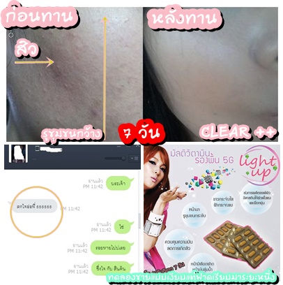 #มัลติวิตามินหน้าเงา