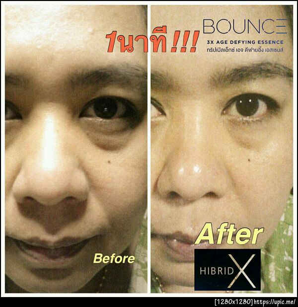 ลดริ้วรอยรอบดวงตา