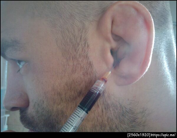 The small syringes just dont cut it anymore!!
