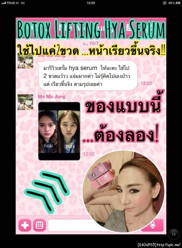 ฝากรูป