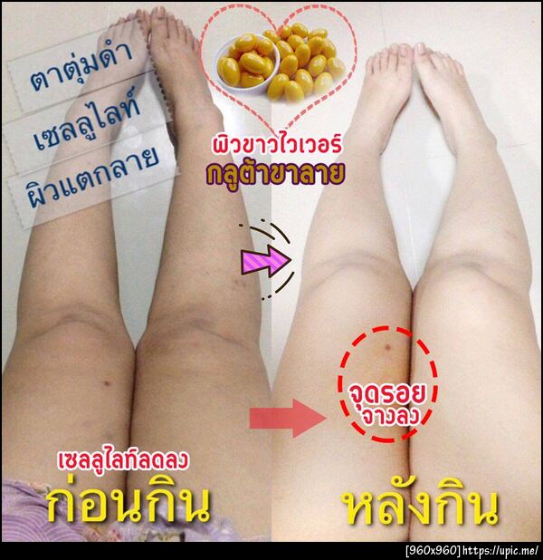 กลูต้าขาลาย1