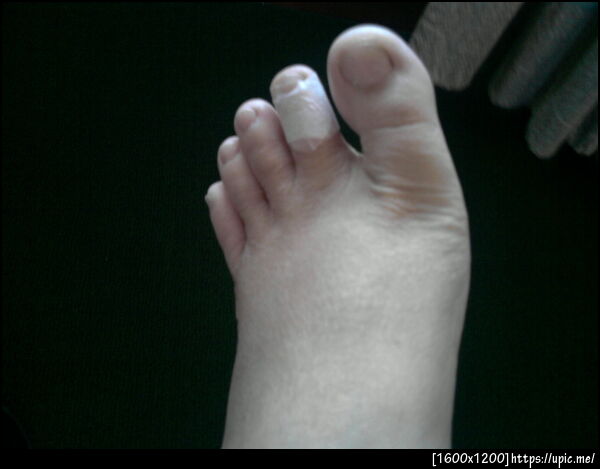 บาดแผลอันปวดร้าวดูจะเล็กแต่เนื้อหายไปแล้ว #fb