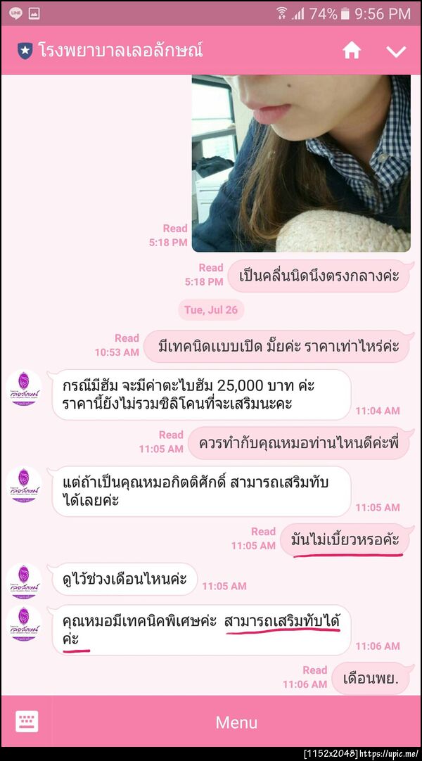 ฝากรูป