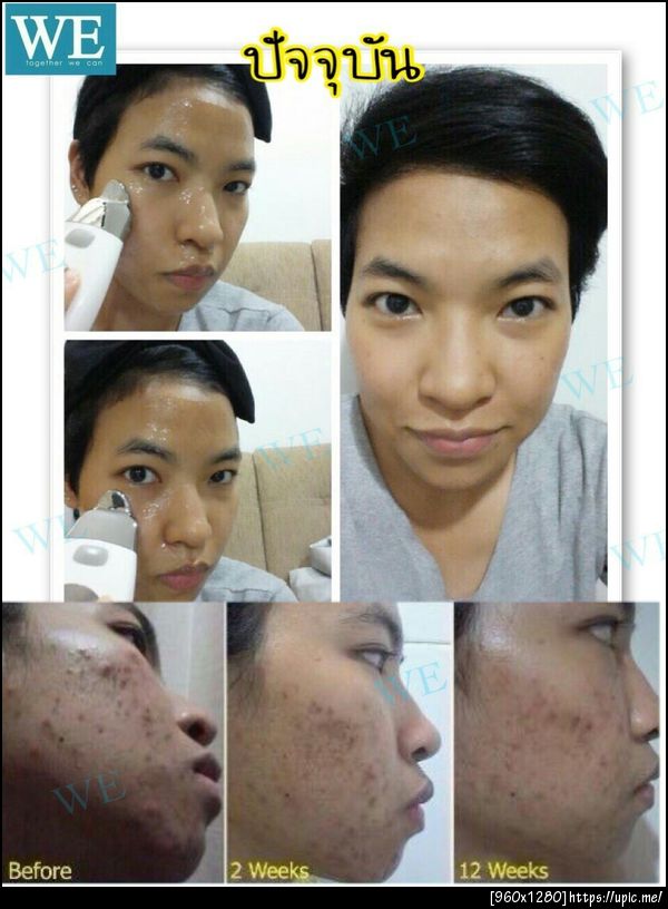 เครื่องสปาหน้าเด็ก