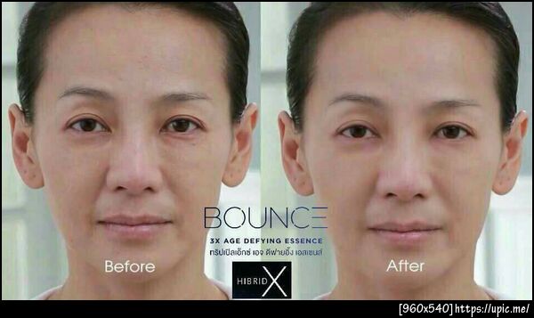 ลดริ้วรอยรอบดวงตา