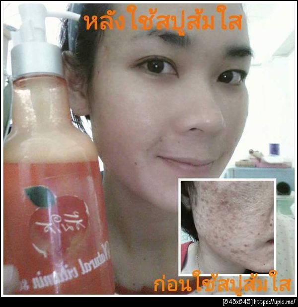 รีวิวผู้ใช้สบู่ส้มใสจริง