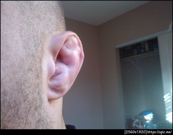 Ear getting worse. Keep draining it and it keeps filling back up