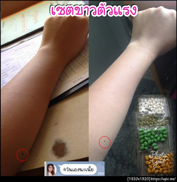 เซตขาวตัวแรง