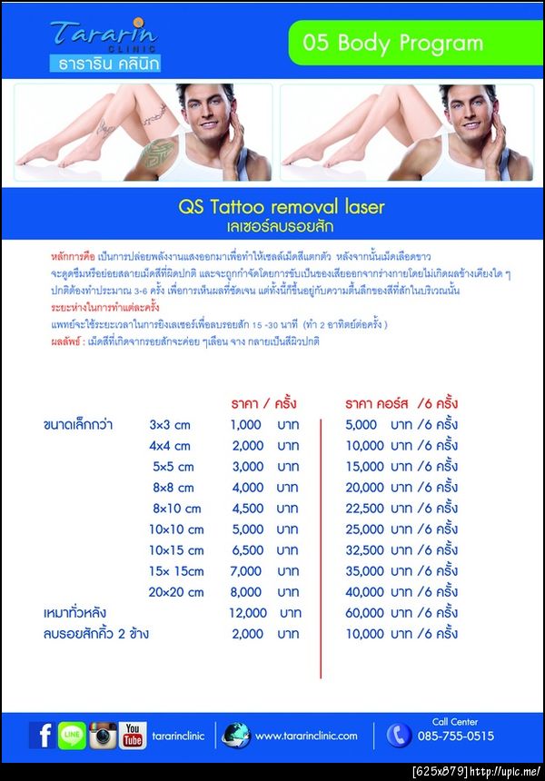 เลเซอร์ลบรอยสัก เห็นผล 100% ขอนแก่น มหาสารคาม