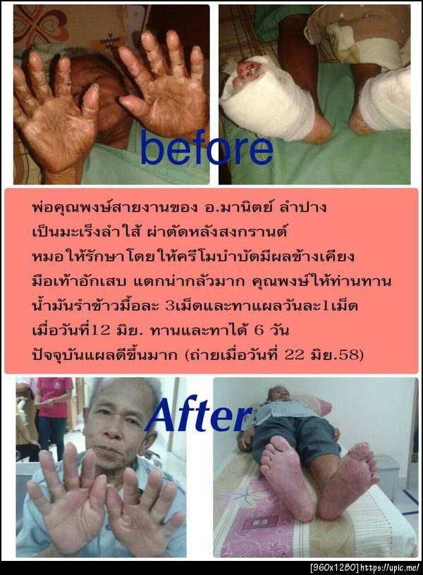 อาหารเสริม