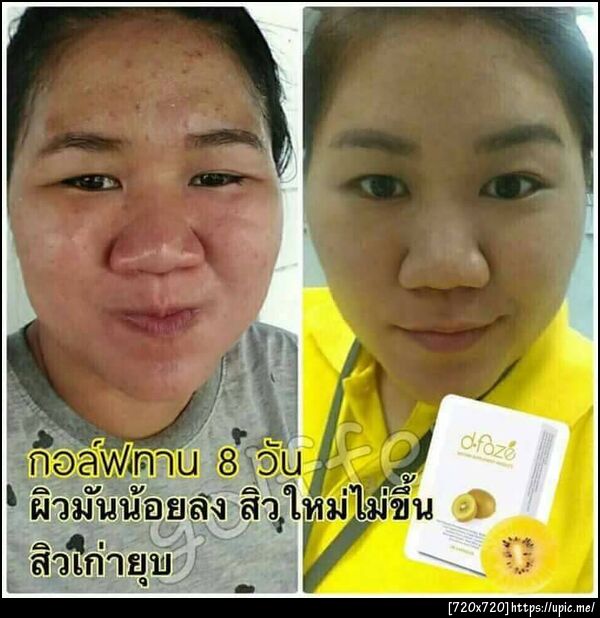 ผิวเรียบเนียน