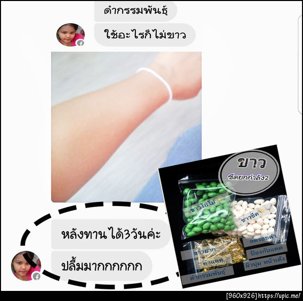 ผิวขาวซีดยกกำลัง2