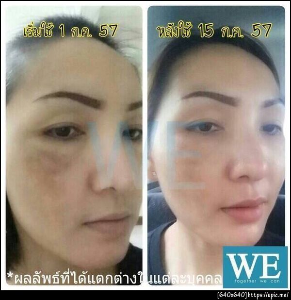 สปาหน้า