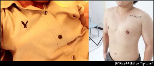 ฝากรูป