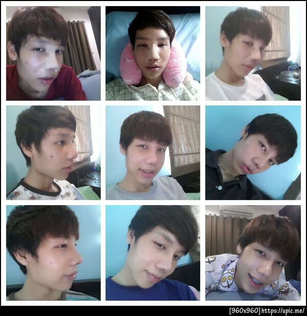 ฝากรูป