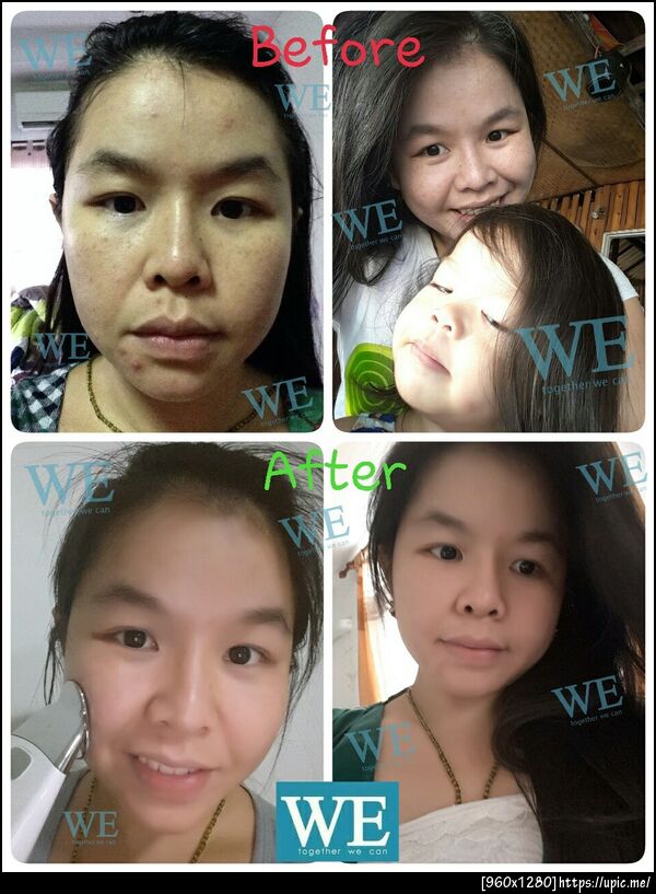 สปาหน้า
