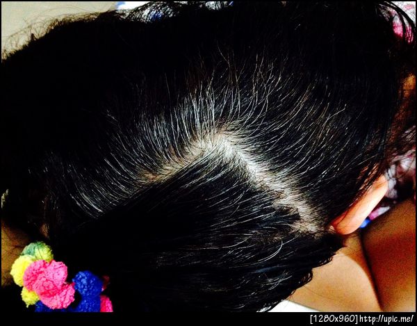 Bitotinช่วยให้ผมหงอกช้าลง,ลดปัญหาผมหงอกก่อนวัย,Biotin7500mgPuritan,Biotin Natrol5000mg By Cherrynatshop LINE:0815446181