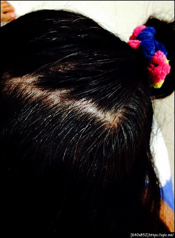 Bitotinช่วยให้ผมหงอกช้าลง,ลดปัญหาผมหงอกก่อนวัย,Biotin7500mgPuritan,Biotin Natrol5000mg By Cherrynatshop LINE:0815446181