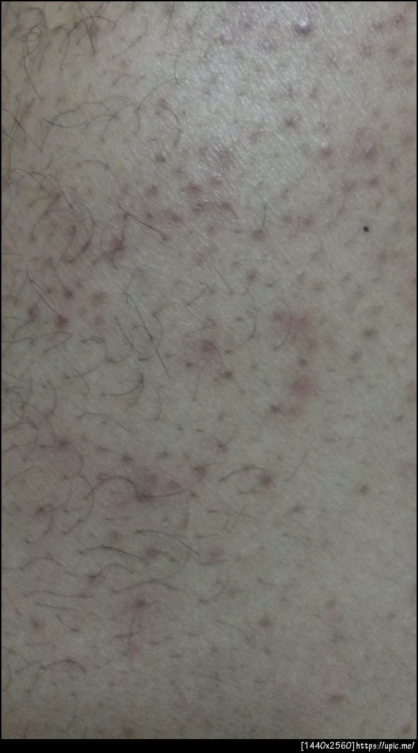 ที่ขาครับ