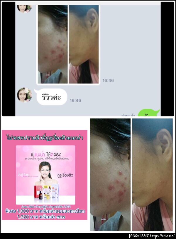 ฝากรูป