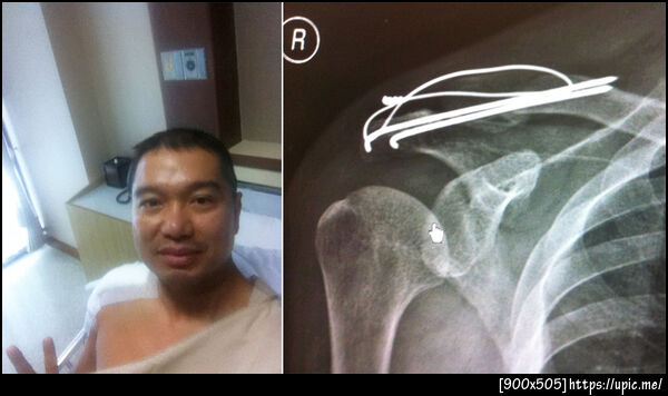 ฝากรูป
