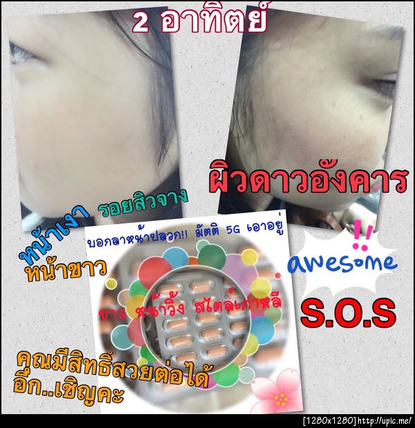 มัตติรองพื้นหน้าเงา 5 G ขาว หน้าวิ้ง บอกลาหน้าปลวก โบกมือลาสิว