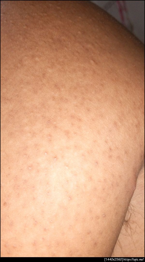 หลังครับ