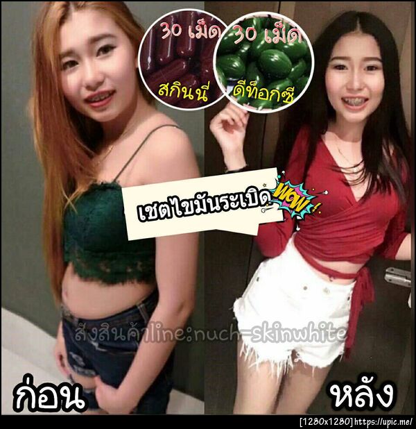ริวิวเซตไขมันระเบิด
